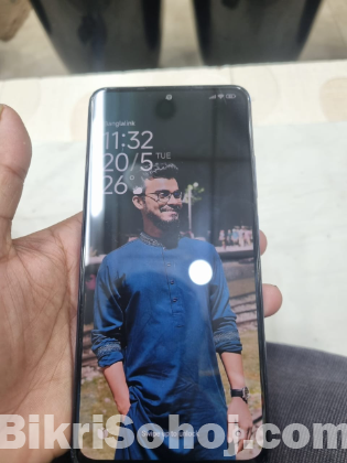 Redmi note 11 pro plus
